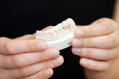 Nurse holding a dental crown