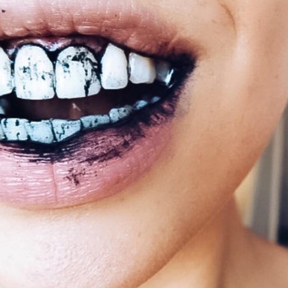 The latest dental trends Oil pulling and Activated Charcoal