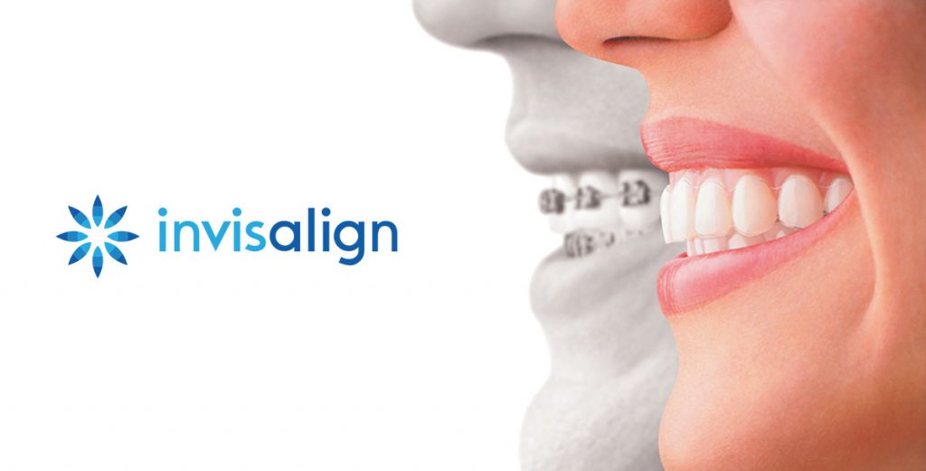 Invisalign - Dentalspa Geelong